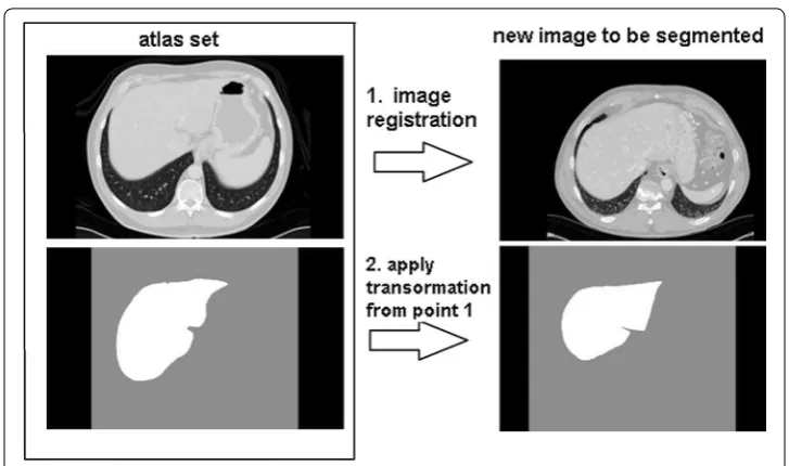 Fig. 1 Concept behind the single atlas-based segmentation [5]
