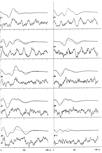 Figure 4In each of 10 subplots, from the bottom: a single AEP, it's reconstruction from wavelet coefficients as in fig