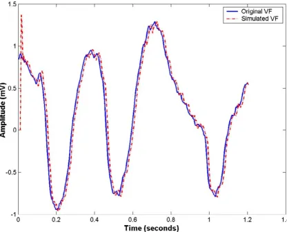 Figure 8A patient ECG and simulated ECG with VF