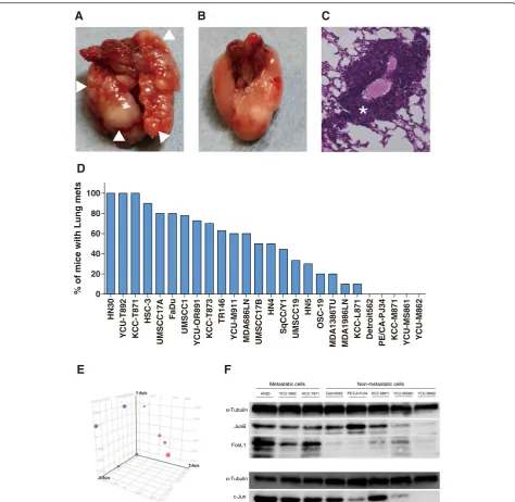 Fig. 1 The distant metastatic potential of 26 HNSCC lines in the experimental lung metastatic mouse model.experimental lung metastatic mouse model of HNSCC