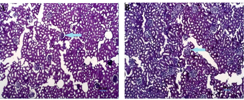 Figure 6. Microscopical section of kidney showing glomeruli (A:Control group) (B:TQ group) (scale bar= 80µm)H&E x10  