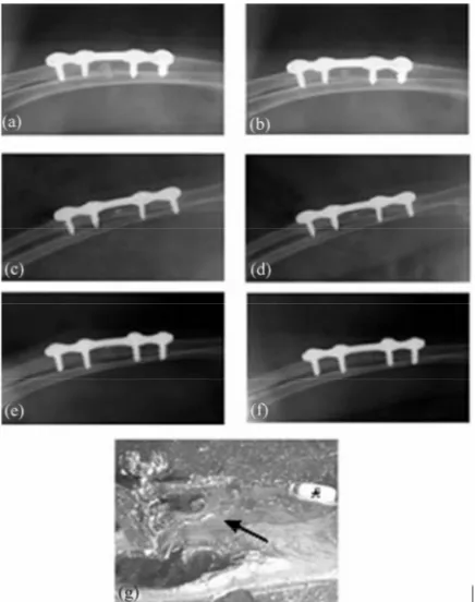 Figure 3. Radiographs of left forearm of a rabbit (#7; Group I) with unilateral discontinuity defect in radius bone fitted with sterile coral implant loaded with homologous osteoblasts taken immediately post-operative (a) and at 4 (b), 6 (c), 8 (d), 10 (e)