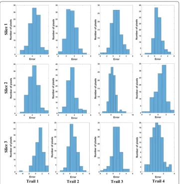 Fig. 8 Temperature error distribution histogram of each pixel within the inner ROI (100 pixels) for body temperature brain experiments (Volunteer #1)