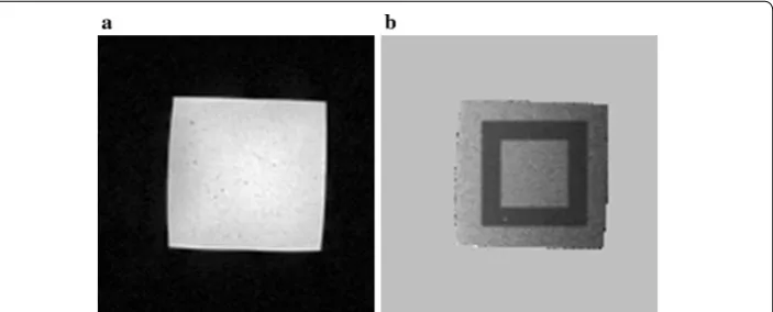 Fig. 1 Gel phantom and ROIs selection. a Magnitude image of an unheated gel phantom. b Black region on phase difference map represents outer ROI and inner ROI is contained in outer ROI