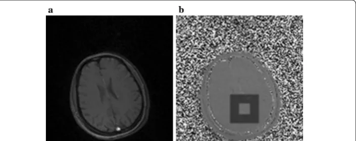 Fig. 3 Human brain and ROIs selection. a Magnitude image. b Inner and outer ROIs on phase difference image