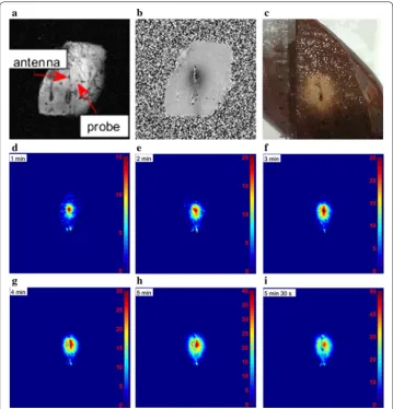 Fig. 6 Phase and temperature changes of the ex vivo porcine liver MW ablation experiments