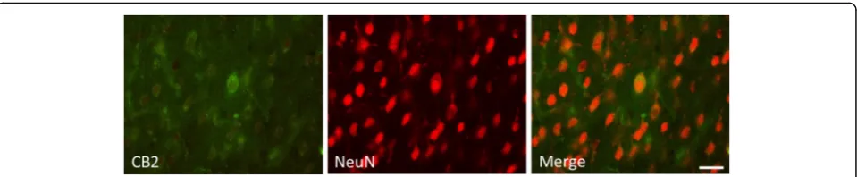 Fig. 5 Double-immunostaining for CB2 and NeuN in the contralateral cortex. Some NeuN+ cells were weakly co-labeled with CB2