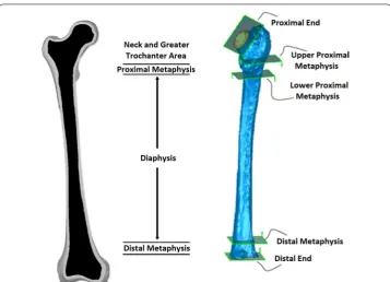 Fig. 3 Five predefined planes for splitting femur into 4 pieces to perform the deviation analysis