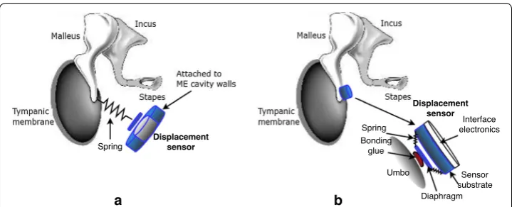 Fig. 5 Capacitive MEMS displacement sensor schemes of connected to the umbo by a spring, and the umbo (Based on information from [a the capacitive MEMS displacement sensor (E1) b the capacitive MEMS displacement sensor (E2) coupled directly to 20, 22])