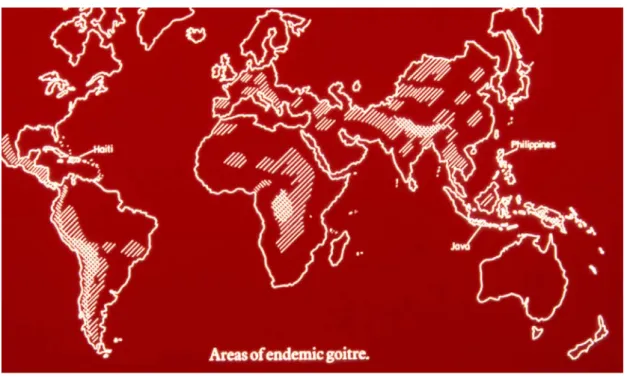 Figure 10.2  Endemic Goitre    