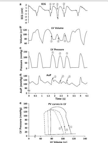 Fig. 6 Representations of (a patient ECGs, b LV volumes, c LV pressures, d AoP and e PV curves during normal ①) and subsequent abnormal heart beat caused by sinus tachycardia (②, ③)