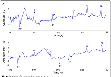 Fig. 6 Examples of incorrect detection in record 203