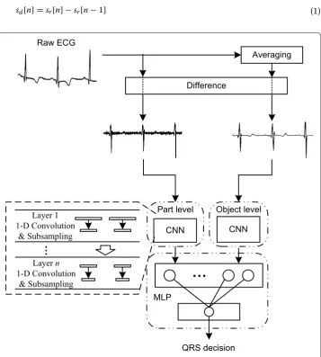 Fig. 1 Overview of the proposed QRS complex detection method