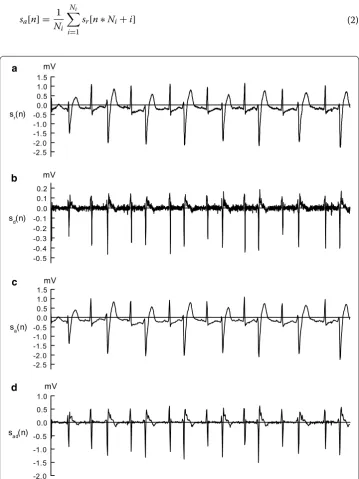Fig. 2 Outputs obtained at preprocessing stage of the proposed method. in the MIT-BIH-AR database; tion; a Raw ECG signal from record 200 b signal obtained by difference operation; c signal obtained by averaging opera-d signal obtained by averaging operation followed by difference operation