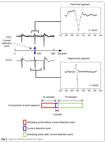 Fig. 3 Segment method used for ECG signal