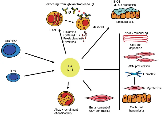 Figure 1 Inflammatory and structural changes in asthmatic airways promoted by IL-4 and IL-13.Abbreviations: ASM, airway smooth muscle cells; iLC2, type 2 innate lymphoid cells; iNOS, inducible nitric oxide synthase; LTs, leukotrienes.