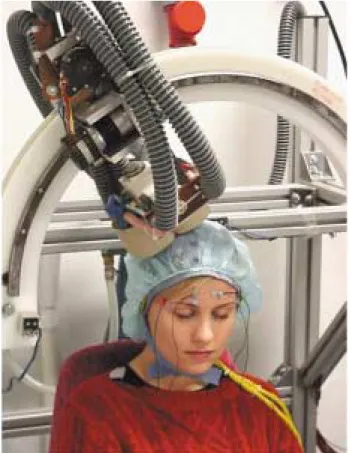 FIGURE 1. Two Types of Transcranial Magnetic Stimulation (TMS) Coils and Representations of the Magnetic Fields They Generate a
