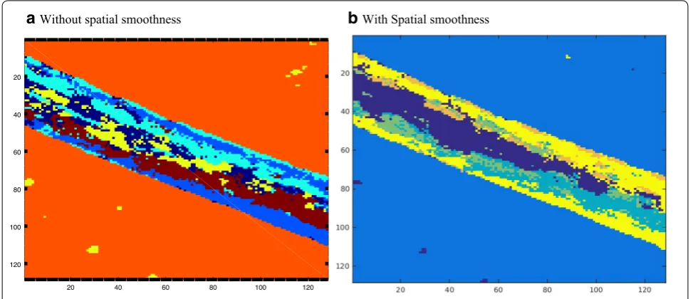 Fig. 8 ToF-SIMS investigations of BFO thin film on LSCO buffer layer and LAO substrate