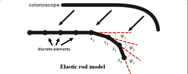 Fig. 3 Geometric modeling of colon and meshing of model