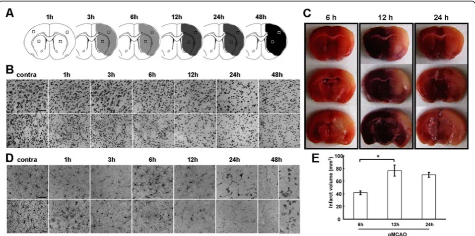 Figure 1 Neuronal death and Ibameans ± SEMs of at least three independent experiments of each group unless otherwise indicated