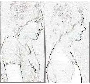 Fig. 4. Startle pattern (Gelb, 1987) 