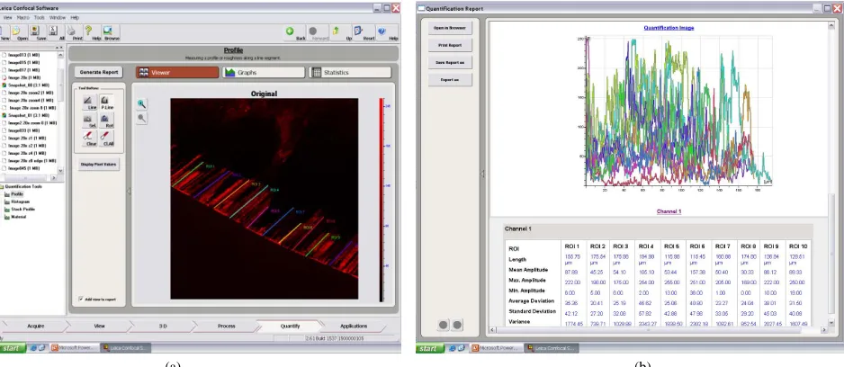 Figure 1. (a) Average linear depth of lesion in µm as seen through confocal laser scanning microscope for both de mineralized and re and re mineralized areas