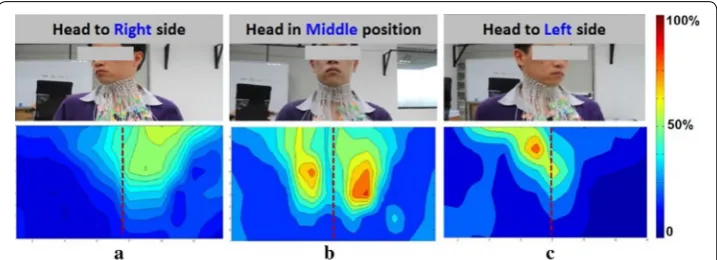 Fig. 7 The dynamic sEMG energy maps when swallowing with three different head postures