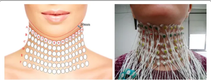 Fig. 1 Placement of high-density electrode array on the front neck
