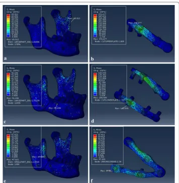 Fig. 11 von Mises stress distribution to the mandible and fixation system under loading I