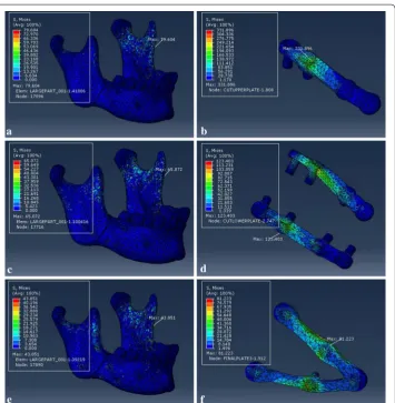 Fig. 12 von Mises stress distribution to the mandible and fixation system under loading II