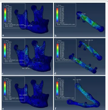 Fig. 13 von Mises stress distribution to the mandible and fixation system under loading III