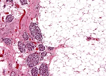 Figure 5. Expression of IL13 in saline-instilled rabbits with or without Losartan pretreatment