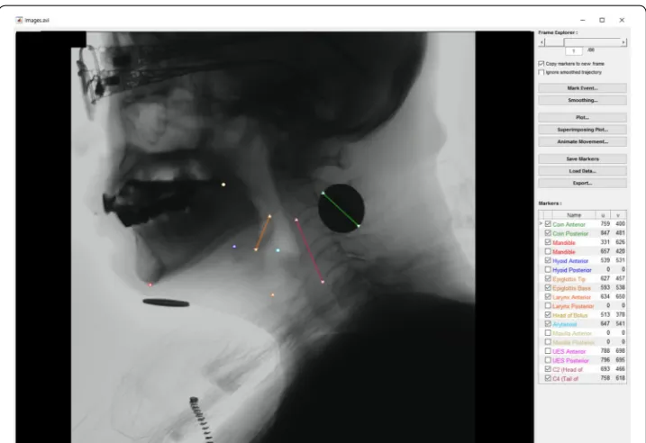 Fig. 2 Main interface of the spatio‑temporal analyzer for motion and physiologic study (STAMPS)