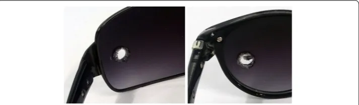 Fig. 4 Sunglasses frames subsequent to the resistance to ignition test