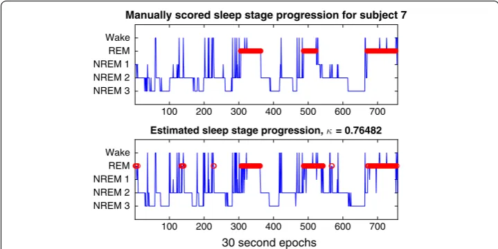 Fig. 5 Comparison of sleep staging results from manual (top) and automatic (bottom) staging, for one subject, using a classifier only trained on data from the same subject