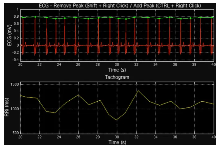 Fig. 1 Example of an electrocardiogram (ECG) tracing with the R-peaks detected (upper panel) and the cor-responding RR interval (RRi) series (lower panel)