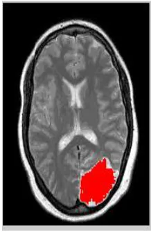 Figure 3 Kmeans Result 