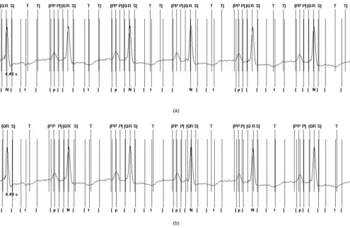 Figure 8(a) and 8(b) show the results of the multi-compo-nent based CC approach and the non-syntactic basedapproach respectively given the instance of First DegreeHeart Block