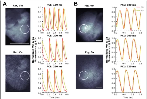 Fig. 4 Normalized transmembrane voltage (RH237,fluorescence signals acquired simultaneously from excised piglet hearts during electrical pacing (180, 200, 220 msec pacing cycle length)
