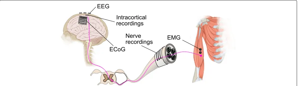 Fig. 1 Overview of various ways to intercept motor control signals. Motor control signal is relayed from the primary motor cortex of the brain, via thespinal cord and peripheral nerve, to the muscle fibers