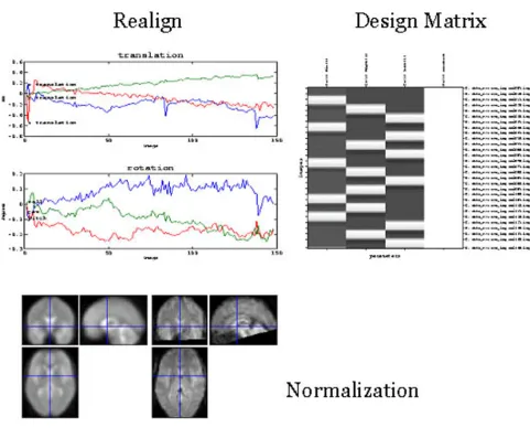 Figure 9Time course of activation for the four stimulus epochs (B binocular, M monocular RL right eye stimulated first, followed by left eye stimulation, LR left eye stimulation first, followed by right eye stimulation)(left panel)Time course of activation