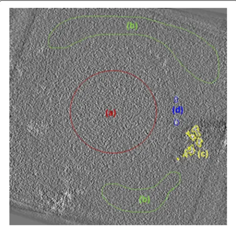 Figure 5in this study where (A) is the reference. We reconstructed summarizes all the methods that we have usedthe 3D volume of the original images (i.e