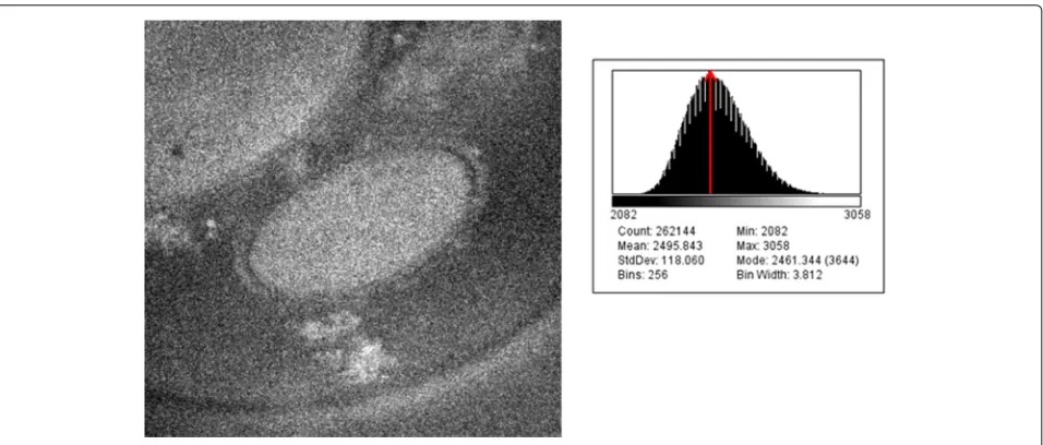 Fig. 7 Histogram of EFTEM image (The EFTEM image number 06 of the 650eV tilt series with its corresponding histogram)