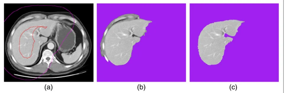 Figure 7 Algorithm Aout,QORFC+GC(So, Sb). (a) Input image with seeds So and Sb. (b) P: χP = Aout,QORFC(So, Sb)