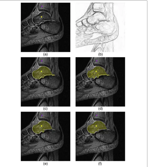 Figure 9 Example results for the different methods.weight assignment from [36]. (a) A talus bone in an MRI slice of a foot with user-selected markers