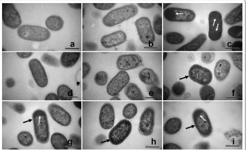 Fig. 4f, i clearly demonstrate that most IBs (black arrow) tend to evenly distribute around the interior of the cell 