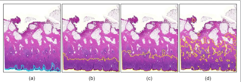 Fig. 2 Comparison of automated epidermis segmentation and manually labeled ground truth