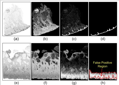 Fig. 5 Illustration of morphological preprocessing. Epidermis mask a b1. b b2. c b3. Note that figures (a–c) are cropped from the whole size imageand zoomed up for clear illustration here