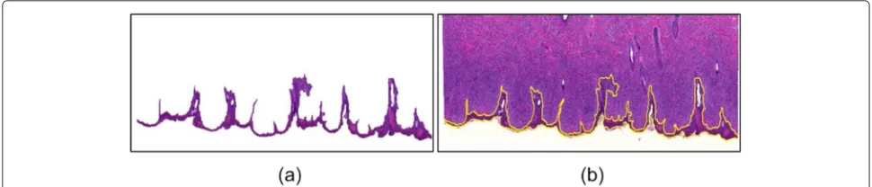 Fig. 11 Fine segmentation result. a Finally segmented epidermis area. b Epidermis contour on the original image