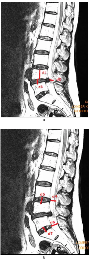Figure 1 a-b. T2 weighted sagittal image of L4T2 weighted sagittal image of L4-L5 LDH
